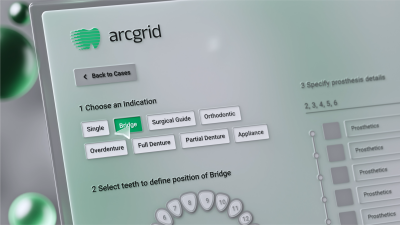 Still image of Arcreal - ArcScan Intraoral Scanner Product Video by Aydream